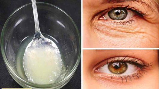 Pourquoi Mettre Du Bicarbonate De Soude Sous Les Yeux Recette Facile