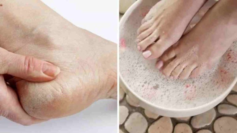 Astuce parfaite pour avoir des pieds beaux et soignés remède maison