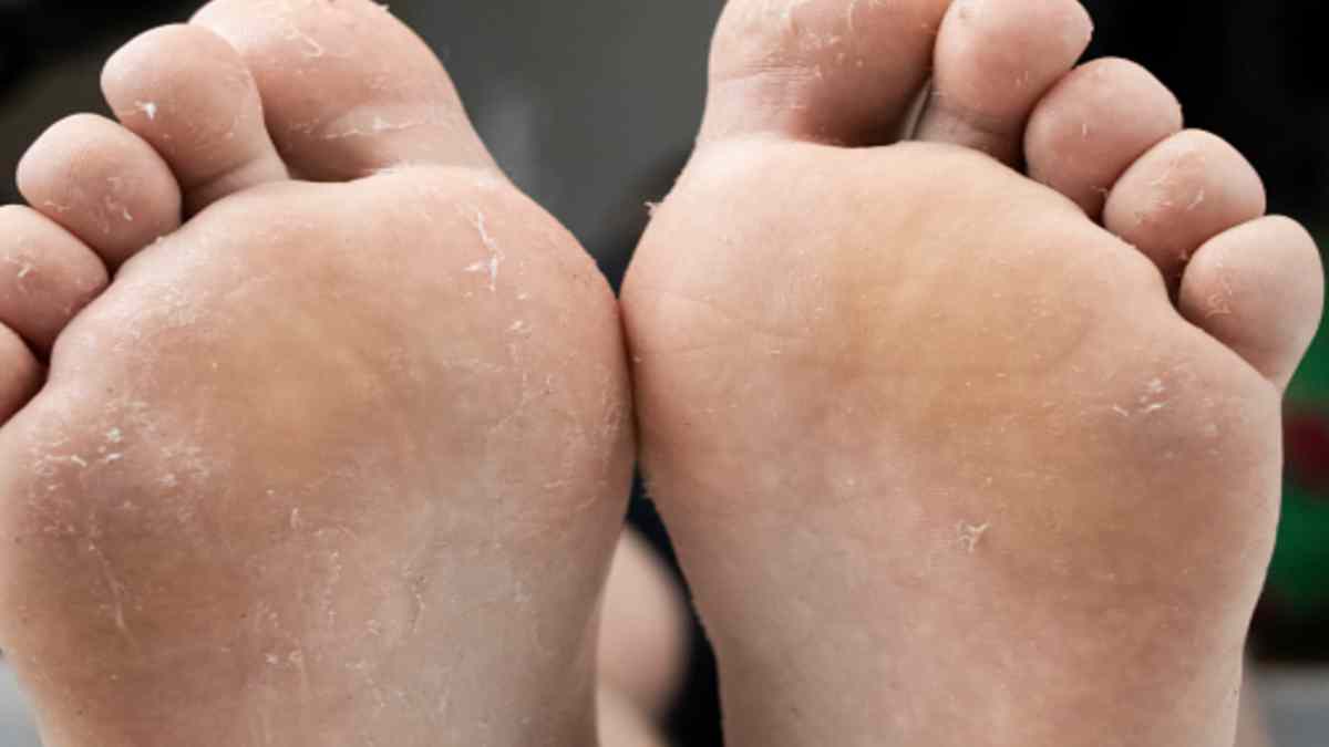 D Couvrez Une Meilleure Astuce Au Bicarbonate De Soude Pour Les Pieds Doux Astuces Au Feminin